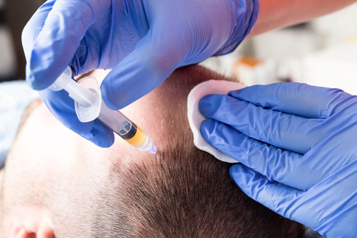PRP Treatment, PRP Injections, PRP For Hair Loss: Vaughan