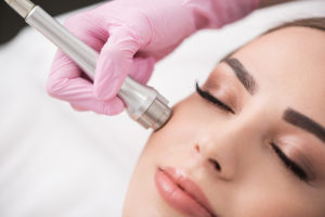Microdermabrasion, Microneedling treatment being received by a lady at medispa